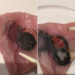 Hair Tourniquets A Risk To Tiny Toes And Other Parts Cpr Kids