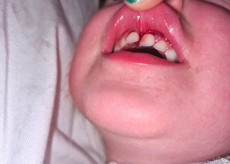 Helpful guides and advice on child & baby health CPR Kids Blog